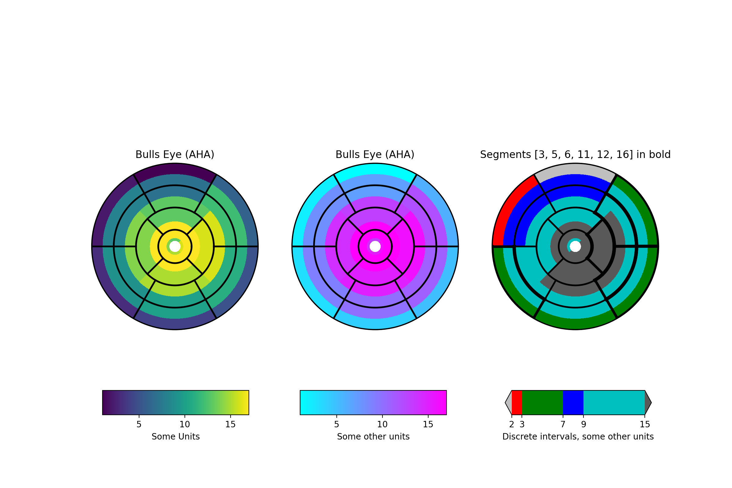 Bullseye du ventricule gauche_Matplotlib —— Python visualisation